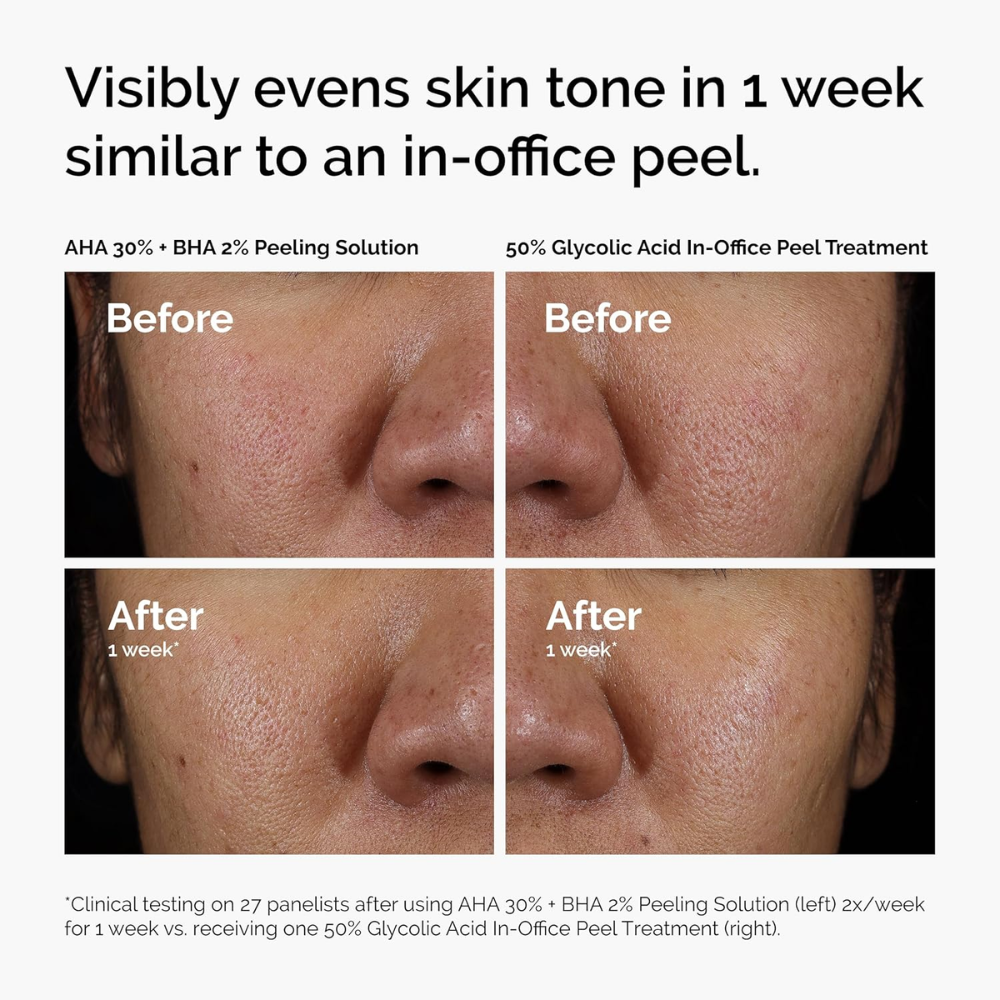 The Ordinary AHA 30% + BHA 2% Peeling Solution 30ml