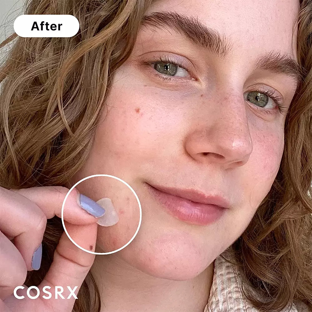 COSRX Acne Pimple Master 24 Patches