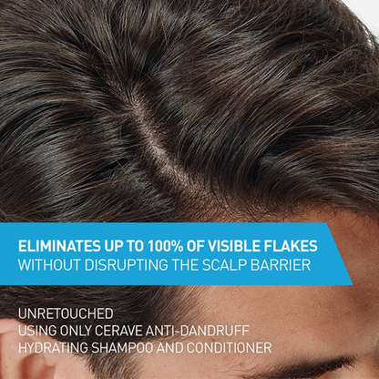 CeraVe Anti-Dandruff Conditioner 266ml