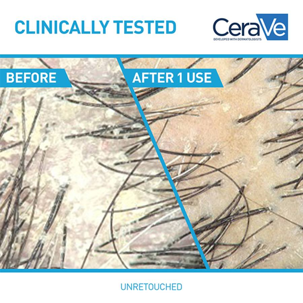 CeraVe Anti-Dandruff Conditioner 266ml