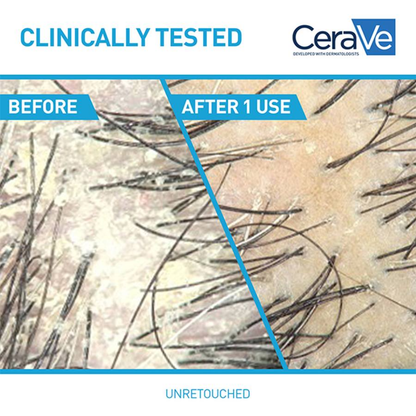 CeraVe Anti-Dandruff Conditioner 266ml