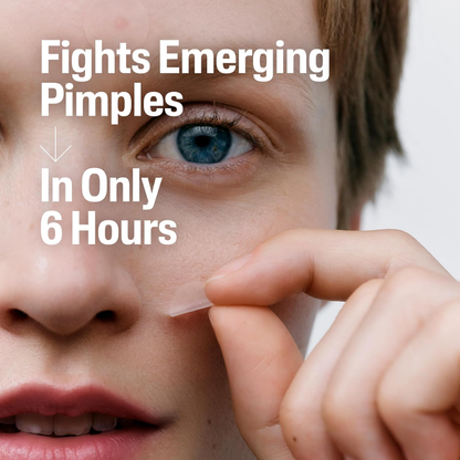 Cetaphil Acne Patches (24 Count)