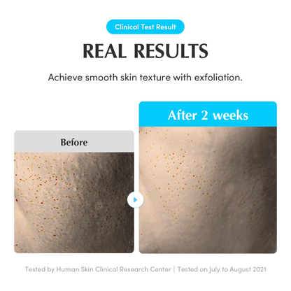 EQQUALBERRY Swimming Pool Toner 300ml