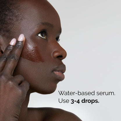 The Ordinary Niacinamide 10% &amp; Zinc 1% S 30ml