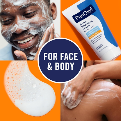 PanOxyl 10% Benzoyl Peroxide Acne Foaming Wash – Maximum Strength