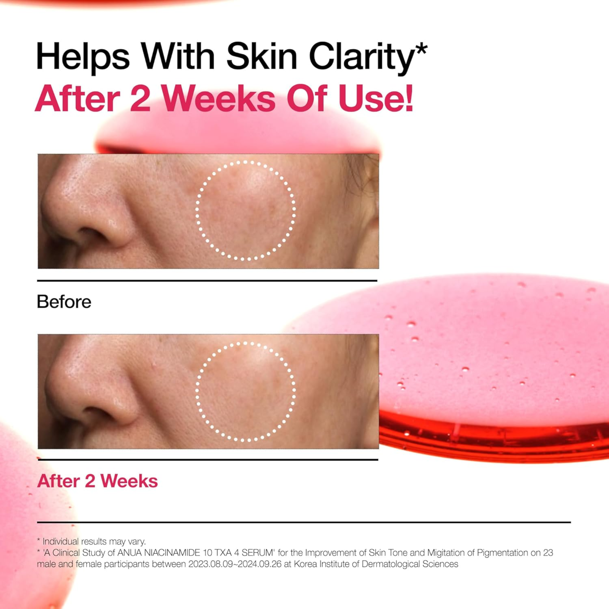 ANUA Niacinamide 10% + TXA 4% Serum (30ml)