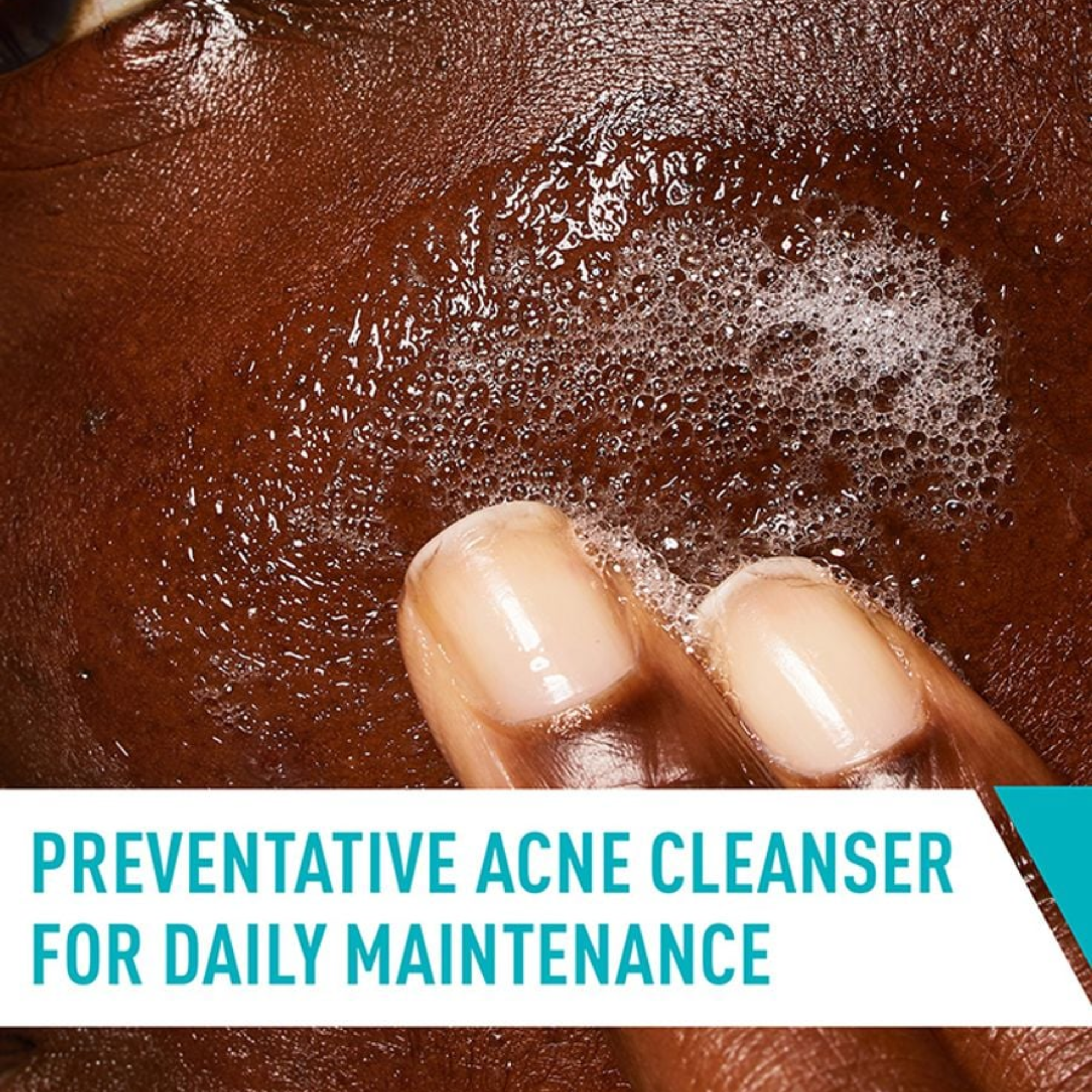 CeraVe Acne Control Cleanser – 237ml