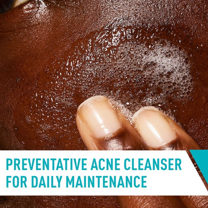 CeraVe Acne Control Cleanser – 237ml