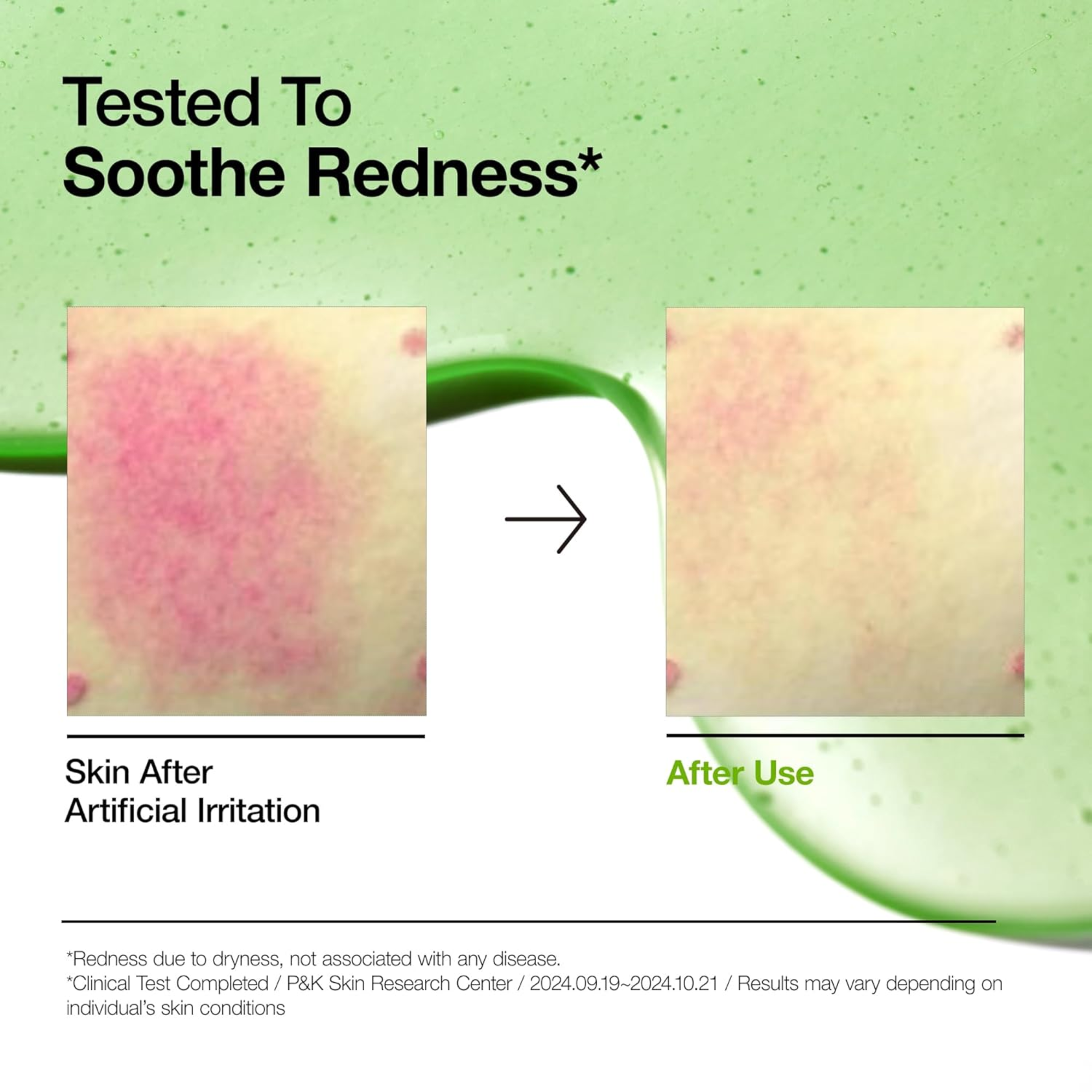 Anua Azelaic Acid 10 Hyaluron Redness Soothing Serum 50ml