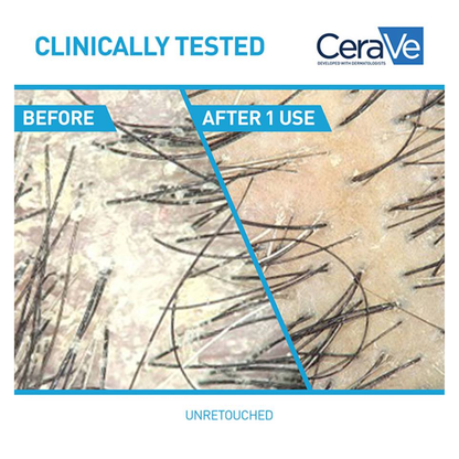 CeraVe 2-in-1 Anti-Dandruff Hydrating Shampoo 355ML