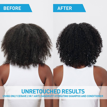 CeraVe 2-in-1 Anti-Dandruff Hydrating Shampoo 355ML